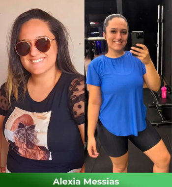 Alexia-Messias-Antes-e-depois-1-768x864-1-2.webp
