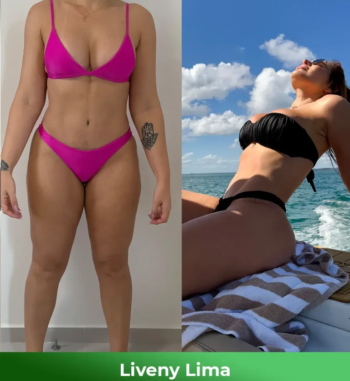 Liveny-Lima-Antes-e-depois-1-768x864-1-2.webp