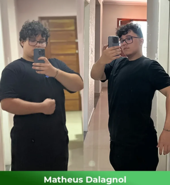 Matheus-Dalagnol-Antes-e-depois-1-768x864-1-2.webp